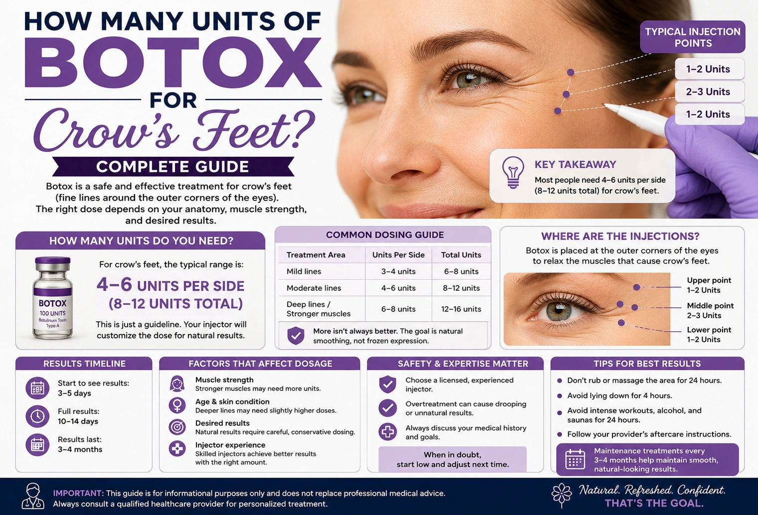 How many units of Botox for crow’s feet